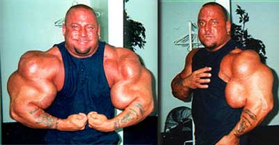 The Man Whose Arms Exploded 99